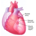Are your post-MI patients achieving the Canadian Cardiovascular Society recommended targets?